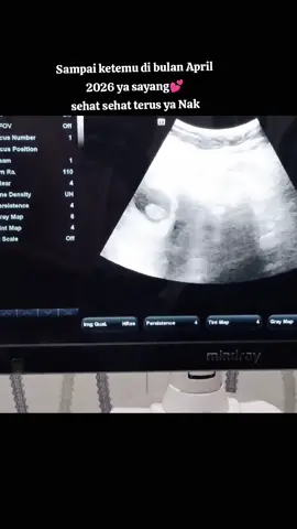 Sehat sehat slalu ya sayang kita berjuang sama sama terimakasih sudah hadir ,,, I Love You Sayang banyak yang menanti kehadiran mu#pregnant🤰 #mybaby #weloveyou #seeyou2026❤️ 