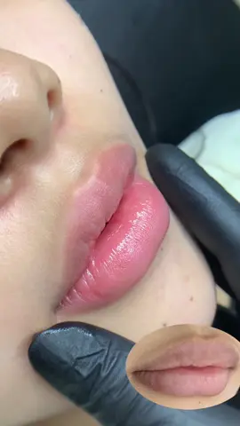 Môi khử thâm sau b0ng nha mấy bà yêu 🥰 #phunmoitunhien #khuthammoi #phunmoicollagen #phunmoitebaogoc #phunmoideptaisaigon     