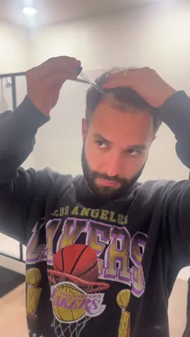 How I apply @HairRescue.Shop serum at night after a shower 🚿🧔🏻‍♂️ #ClimaQuenteCabeçaFria #jjaybeardedbarber #turlockbarber #modestobarber #hairrescue 