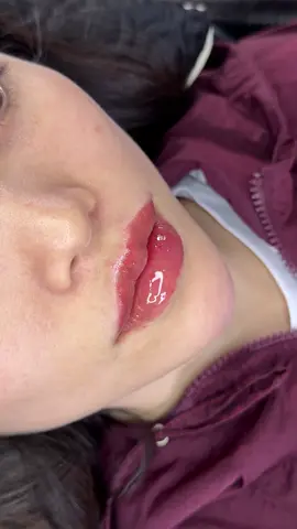 Xinh cá #môixinh #filler #môibaby 