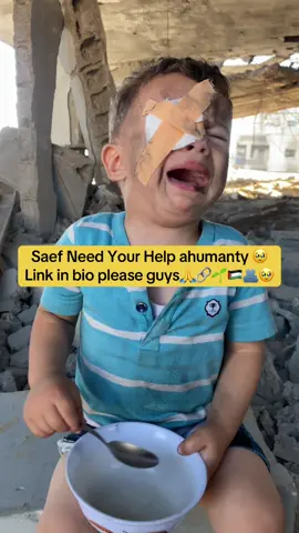 #Gaza #palstine🇵🇸 #eyeslipsface  #injury  Our children do not know why all this is happening, and for whom 🥹 the children must take care of him and teach them the future, security and peace, not murder, bombing and hunger, human🙏