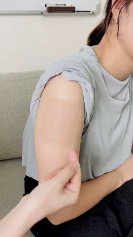 Có vết bớt thế này không biết nên mặc gì cho đẹp…