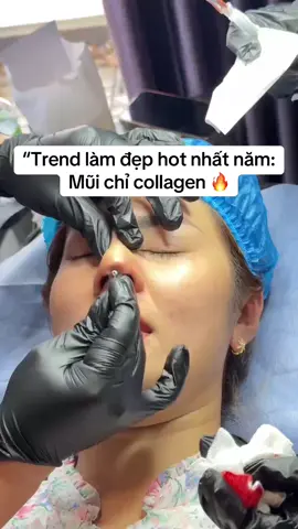 #NângMũiChỉ #MũiĐẹpTựNhiên #KimBeauty #FillerBotoxCăngChỉ #MũiCao 