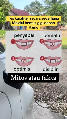 #fypシ゚viral #bentukgigi