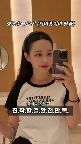 ❗️공유마감❗️어릴때부터 짱구이마, 황비홍이라 놀림받던 소녀🤢 그래도 아빠가 물려주신 내이마가 너무너무 좋았는데 (예쁘단 말을 더 많이 들었음🤍) 생각지도 못한 변수 산.후.탈.모🦭 헤어팡팡이 없이는 절대 커버가 안됐고 생얼일땐 무조건 모자는 필수라 고민이 많았습니다. 고민끝에 이마축소술 받았는데 완전만족입니다🩷 모발이식술이랑 고민했는데 왜 이마축소술로 선택했는지는 유튜브로 알려드릴게요! 제가 선택한 병원은 에르메*처럼 한땀한땀 예쁘게 꼬메줘서 수술부위가 너무 깔끔하게 완성된다는 병원이라 거의 1년을 신중히 알아본 병원이예요. 궁금하신 분들은 댓글 남겨주시면 바로 답변 드립니다🤍 ❗️아무래도 멀쩡한 살을 잘라내는 수술이다보니 저처럼 이마가 너무 벗겨졌거나 탈모로 고민이신분만 추천드립니다. #성형후기 #이마축소술 #이마축소술후기 #황비홍 #넓은이마 