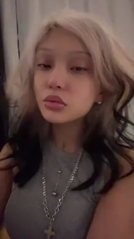 i hit my head