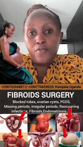 ‎✅ failed to get pregnant? ‎✅Do you need yonipearls? ‎✅Do you have fibroids?  ‎✅Do you have serious menstralcramps ? ‎✅Do you suffer from bacteriavaginoisis?    ‎✅Do you have overiancyst? ‎✅Do you suffer from pid?  ‎✅Do you have pcos?  ‎✅Do you have blockedtubes? ‎✅Do you have recurring yeastinfection, candida or UTIs?  ‎✅Have you failed to get pregnant? ‎✅Do you have missingperiods?  ‎✅Do you have irregularperiods?  ‎✅Do you have heavyperiods?   ‎✅Do you have hormonal imbalance ?  ‎✅Do you suffer from infertility ‎✅Do you have endometriosis? ‎✅Do you have low sperm count ? ‎✅Do you have Azoospermia ? ‎✅Do you have weak sperms? ‎✅Do you have hydrocele? ‎✅Do you have varicocele? ‎#fertility #howtogetpregnantreallyfast #naturalremedies #concievefast #pregnant 