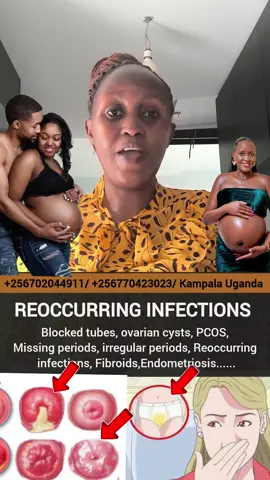 ‎✅ failed to get pregnant? ‎✅Do you need yonipearls? ‎✅Do you have fibroids?  ‎✅Do you have serious menstralcramps ? ‎✅Do you suffer from bacteriavaginoisis?    ‎✅Do you have overiancyst? ‎✅Do you suffer from pid?  ‎✅Do you have pcos?  ‎✅Do you have blockedtubes? ‎✅Do you have recurring yeastinfection, candida or UTIs?  ‎✅Have you failed to get pregnant? ‎✅Do you have missingperiods?  ‎✅Do you have irregularperiods?  ‎✅Do you have heavyperiods?   ‎✅Do you have hormonal imbalance ?  ‎✅Do you suffer from infertility ‎✅Do you have endometriosis? ‎✅Do you have low sperm count ? ‎✅Do you have Azoospermia ? ‎✅Do you have weak sperms? ‎✅Do you have hydrocele? ‎✅Do you have varicocele? ‎#fertility #howtogetpregnantreallyfast #naturalremedies #concievefast #pregnant 