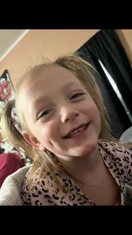 My beautiful baby girl her teeth are looking so much better after usen the NOBSkids toothpaste still a long way to go#fyp #nobstoothpaste #momlife 