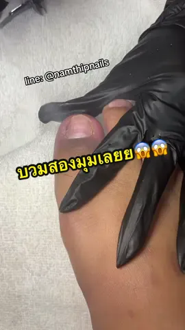 💓 #namthipnails #ตัดเล็บขบ #ตัดหนัง #ทำเล็บ #ร้านตัดเล็บขบ      Fb : namthipnails  Line : @namthipnails  นัมเบอร์วัน8 ตลาดม.ราม2  กทม  Map: namthipnails  https://goo.gl/maps/JmwpCKLfKwmhKGK96  ร้านเปิดทุกวัน เวลา12.00น-22.00น.