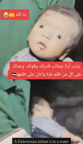 #غزة #معاناه أطفال غز ه # الدعاء لهم #🙏🙏🙏  طفل فلسطيني مت أصحاب  الهمم ارجو الدعاء له بالشفاء اللهم آمين 