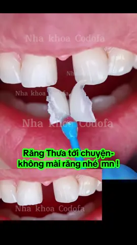 răng thưa tới chuyện ?  không  mài răng ạ ! #trám_răng_thưa #trám_răng_sâu  #dánsứveneer #khôngmài_nhỏ_răng #nhakhoacodofa 