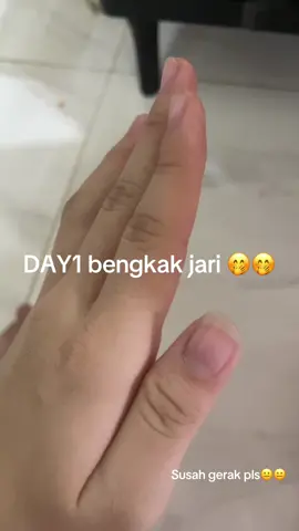 mau tau kenapa cari tau sendiri☺️☺️#fyp #basketball🏀 #jari #bengkak 