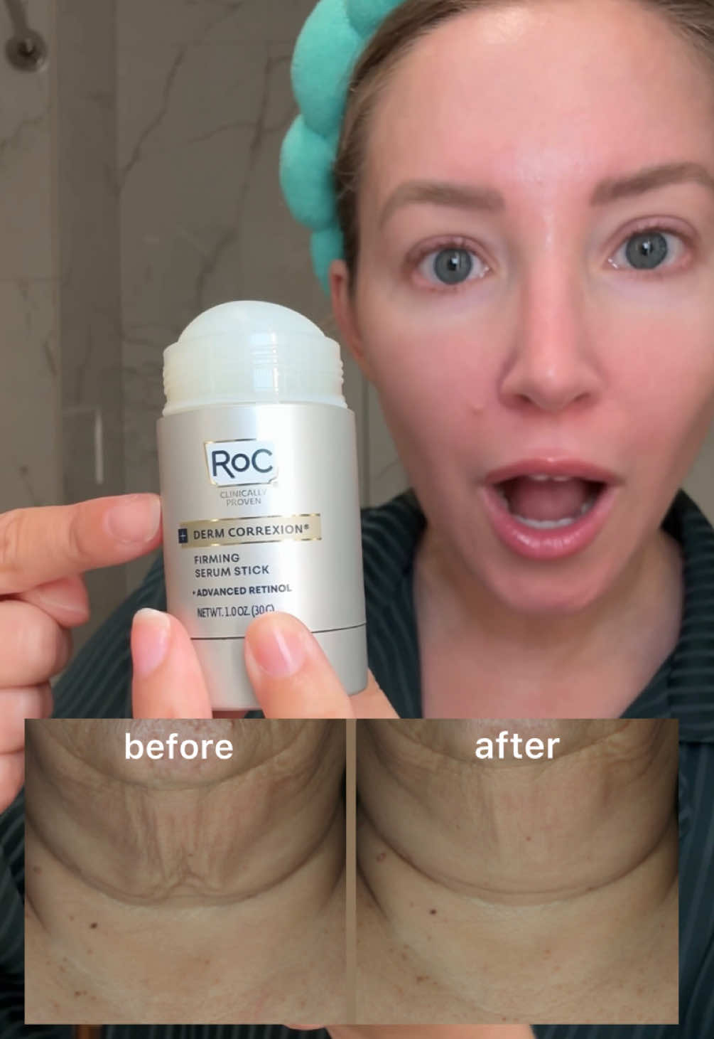a neck game changer in a STICK ✨ @RoC Skincare #roc_partner #rocskincare #skintok 