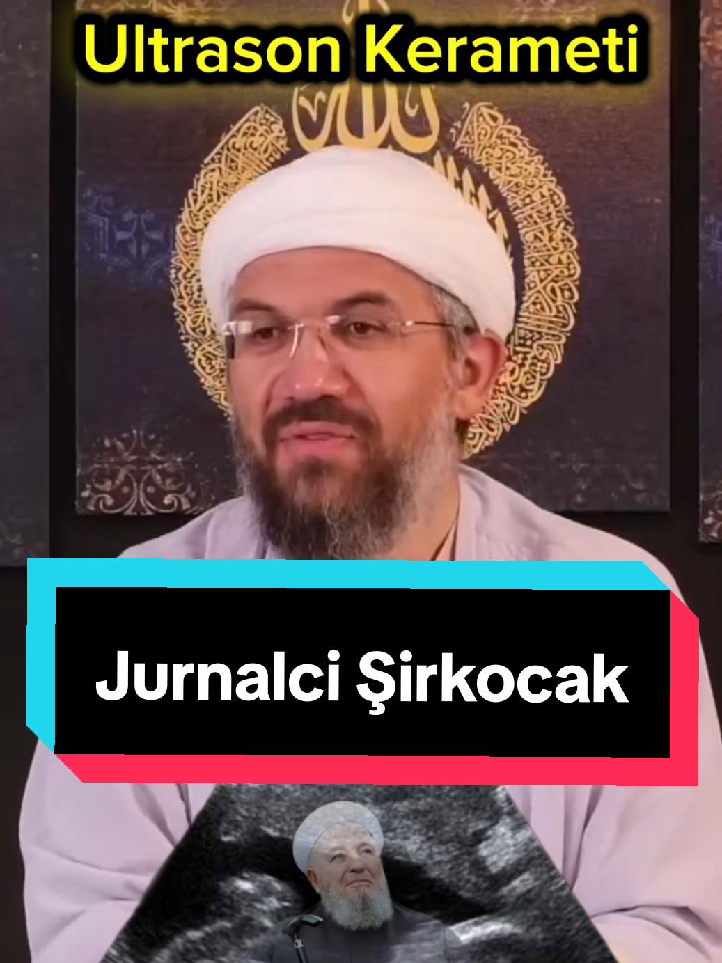 Jurnalci lakaplı İhsan Şenocak, Mahmut efendinin, ultrason sonuçlarında bebeğe erkek denmesine rağmen kız olacağını söylediğini ve çocuğun kız çıktığını iddia etti. #ihsanşenocak #mahmutefendi #evliya #keramet #kesfetedüş 