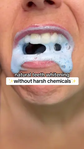 i can’t use the whitening pens or harsh chemicals because my teeth are so sensitive and I have Invisalign but this toothpaste has been amazing to say the least🙏🏼🙏🏼 fluoride free, probiotic packed AND the flavor is top tier ❤️❤️❤️ immediate lifelong customer 🤌🏼 #msdrwikey #whiteningtoothpaste 