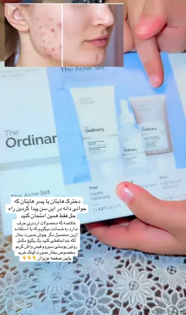 #The #acne #set #viral_vide 