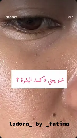 شو يعني تأكسد البشرة ؟ تابع معنا واحصل على معلومات عن وشاكل البشرة وما علاجها  ladora_by _fatima