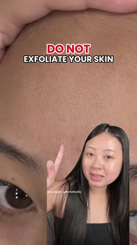 Sometimes exfoliating isn't always the answer. I used to think flaky skin meant to exfoliate and got irritated when I did that and my skin got worse. Luckily now I know 👏🏼 #barrierrepair #dryflakyskin #skinbarrier #skincaretips #sensitiveskin @Eau Thermale Avène 
