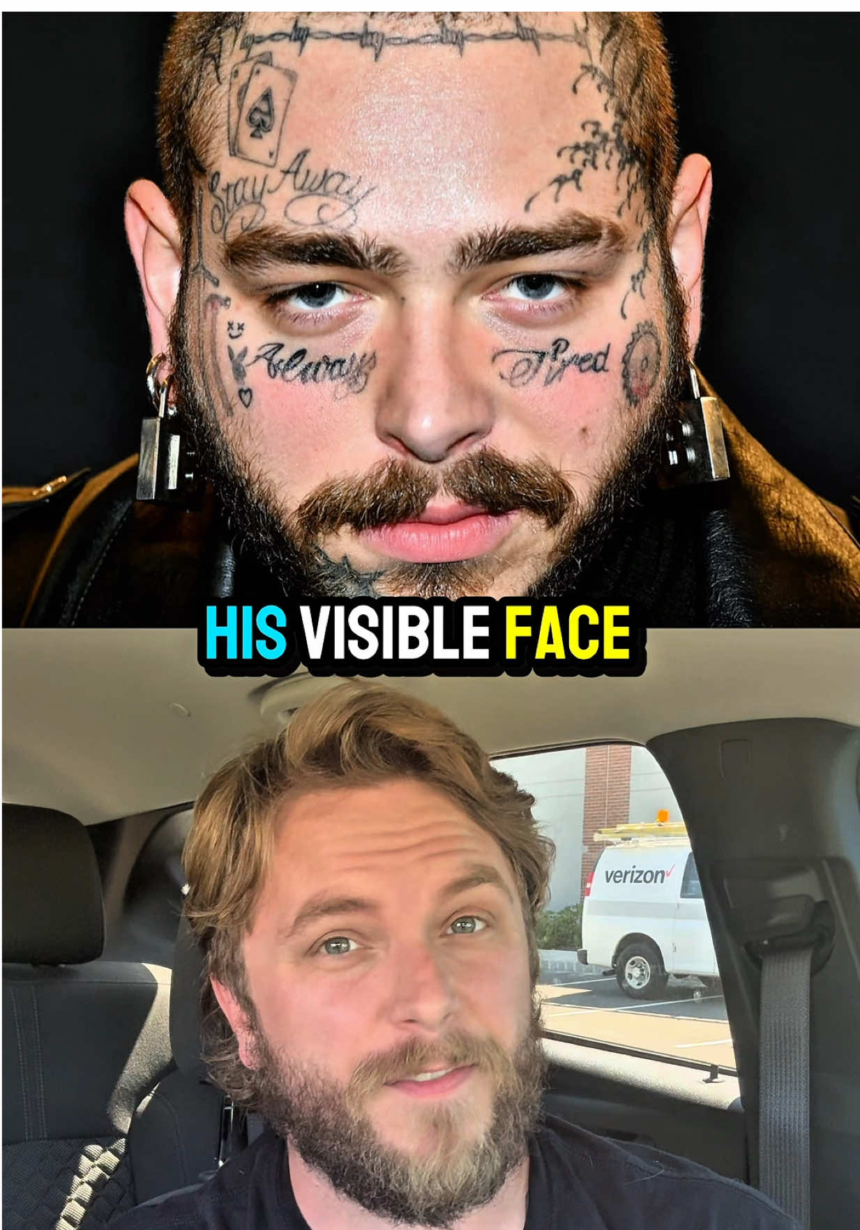 2 Celebrities who regretted and removed their tattoos - Part 23