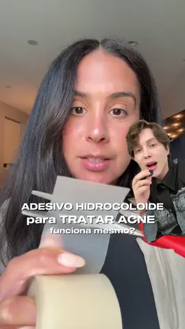 UAU 😨  Quando falamos em fita hidrocoloide (como aquelas usadas para curativos) e em adesivos hidrocoloides específicos para acne, estamos falando da mesma base tecnológica: o hidrocoloide, um material que cria um ambiente úmido, acelera a cicatrização e absorve o excesso de secreção da lesão. A diferença está no tamanho, espessura e na formulação. As fitas hidrocoloides foram criadas para tratar feridas maiores e são mais espessas, podendo ser cortadas e adaptadas para cobrir espinhas. Já os adesivos hidrocoloides para acne são versões otimizadas: mais finos, discretos e com recorte pensado para aderir melhor ao rosto, além de muitas vezes possuírem aditivos calmantes ou antibacterianos. Ambos funcionam para acelerar a cicatrização da acne inflamada, reduzir o risco de cicatriz e proteger a lesão de bactérias e do toque constante. Porém, os adesivos dermatológicos trazem praticidade e estética para o dia a dia, enquanto a fita comum pode ser uma alternativa acessível e eficaz, desde que usada corretamente. #hidrocoloide #espinhas #acne #peleacneica #peleoleosa 
