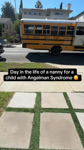His dad said if it has worsened they may have to do surgery, and I just don’t want him to have another surgery 🥺 but I get it if it’s to help him of course 💜🥰🥺🥹💜 #angelmansyndrome #specialneeds #caregiver #nanny #dayinthelife #viral #foryou 