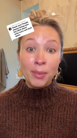 Replying to @a.n.g.ela_ melasma where#tarte #tartecosmetics #melasma #melasmatreatment @tarte cosmetics 