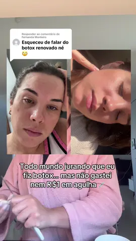 Respondendo a @Fernanda Monteiro Pode parecer botox, mas não é! 😅 Eu nunca fiz procedimento estético. Só inclui esse colágeno na minha rotina diária e tô sentindo minha pele muito mais firme e com glow 🫶🏻 #fyy #multicolageno #autocuidado #rugas 