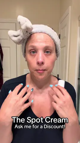 Musely's The Spot Cream contains prescription strength ingredients 10x stronger than OTC skincare products so you see visible reduction in dark spots after just a few weeks. @Musely #thespotcream #musely #melasma #melasmatreatments #prescriptionskincare   