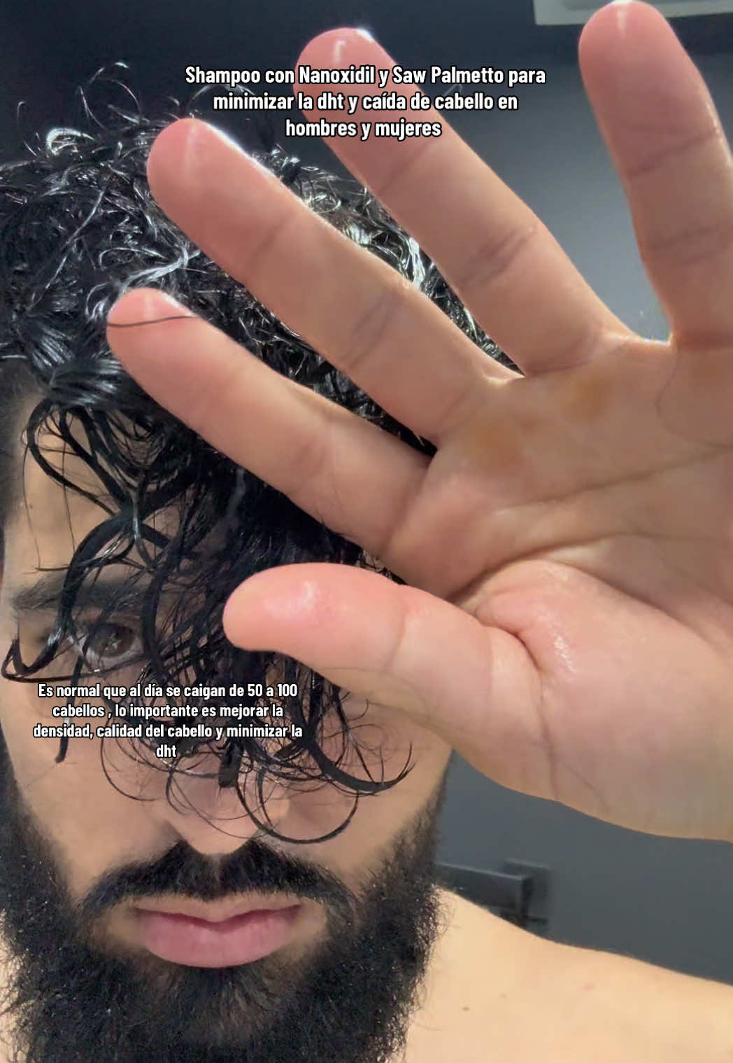Shampoo con Nanoxidil y Saw Palmetto para minimizar la dht y caída de cabello en hombres y mujeres  • no se enfoquen tanto en no perder cabello es algo normal y a mi me pasa todos los días, la clave es mejorar la calidad de ese cabello, mejorar la densidad, el crecimiento y minimizar la dht y en base a ello el cabello mejorará mucho más sin importar que se siga cayendo un poco  #shampoo #thinninghair #hairgrowth #hairlosstreatment #scalptreatment 