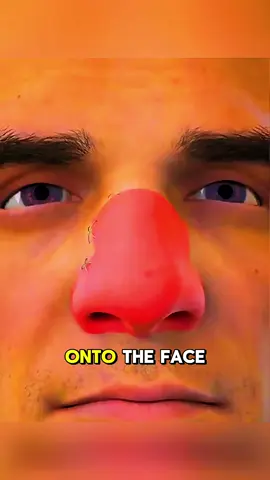 Nose Reconstruction Surgery - 3D Animation   #NoseReconstruction #ReconstructiveSurgery #PlasticSurgery #3DMedicalAnimation #MedicalAnimation