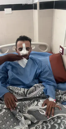 #viral بنج العمليات ده غريب جداً