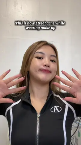 @YOU Beauty Philippines This is it! acne scars removal for face #acne #skincare #recommendations #YOUBeautyPH #YOUAcnePlus 