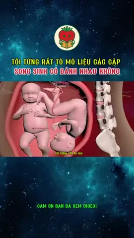 liệu các cặp song sinh trong bụng có va nhau không #xh #kienthucthuvi #LearnOnTikTok #khampha #khamphathegioi 