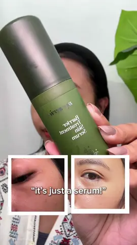 No, it’s not just a serum 💧 It’s a Barrier Treatment Skin Serum that works from the inside out: 🌸 Strengthens your skin barrier 💧 Locks in deep hydration 🛡️ Shields against UV, pollution & free radicals ✨ Smooths and refines skin texture 🌙 Supports skin repair overnight Because healthy skin starts with a strong barrier 💖 #fyp #myseries #myseriesskincare #barrier #skinbarrier 