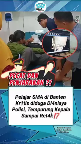 Pelajar SMA Di Banten KRITIS Diduga DIANIAYA Polisi, Tempurung Kepala Sampai RETAK!?😲😲. AYOK  KITA BANTU SEBARKAN BERITA INI SAUDARA