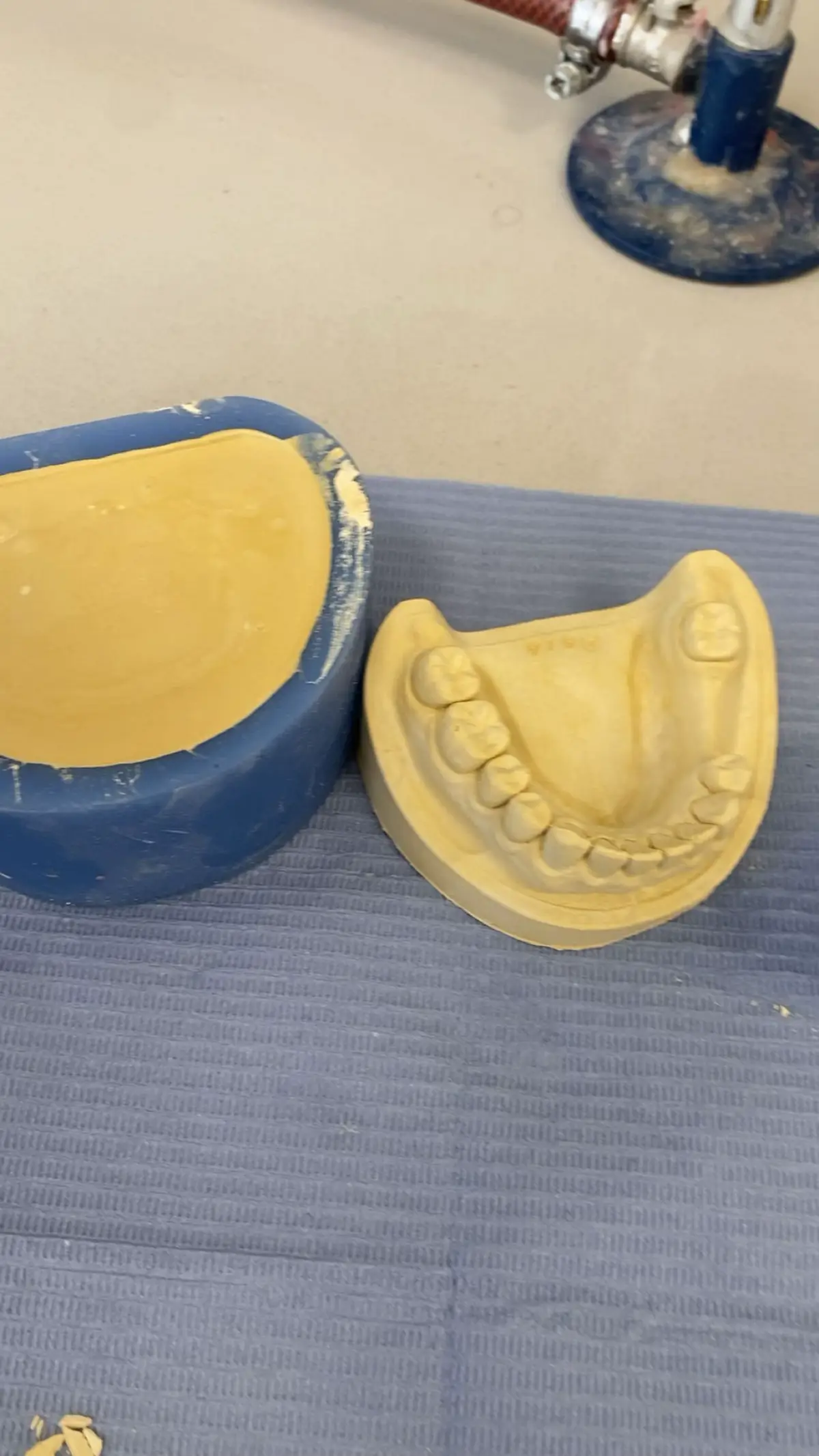 Removable partial dentures 🦷 #الجامعه_العربيه_الامريكيه #جنين #فلسطين #fyp #ตามจังหวะ 