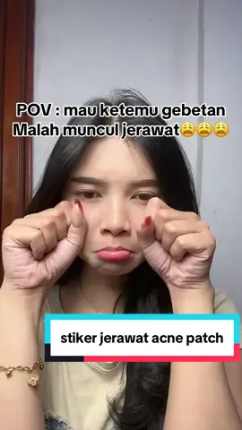 stiker jerawat acne patch karakter Murah #stikerjerawat #AcnePatchWorth #fyp 