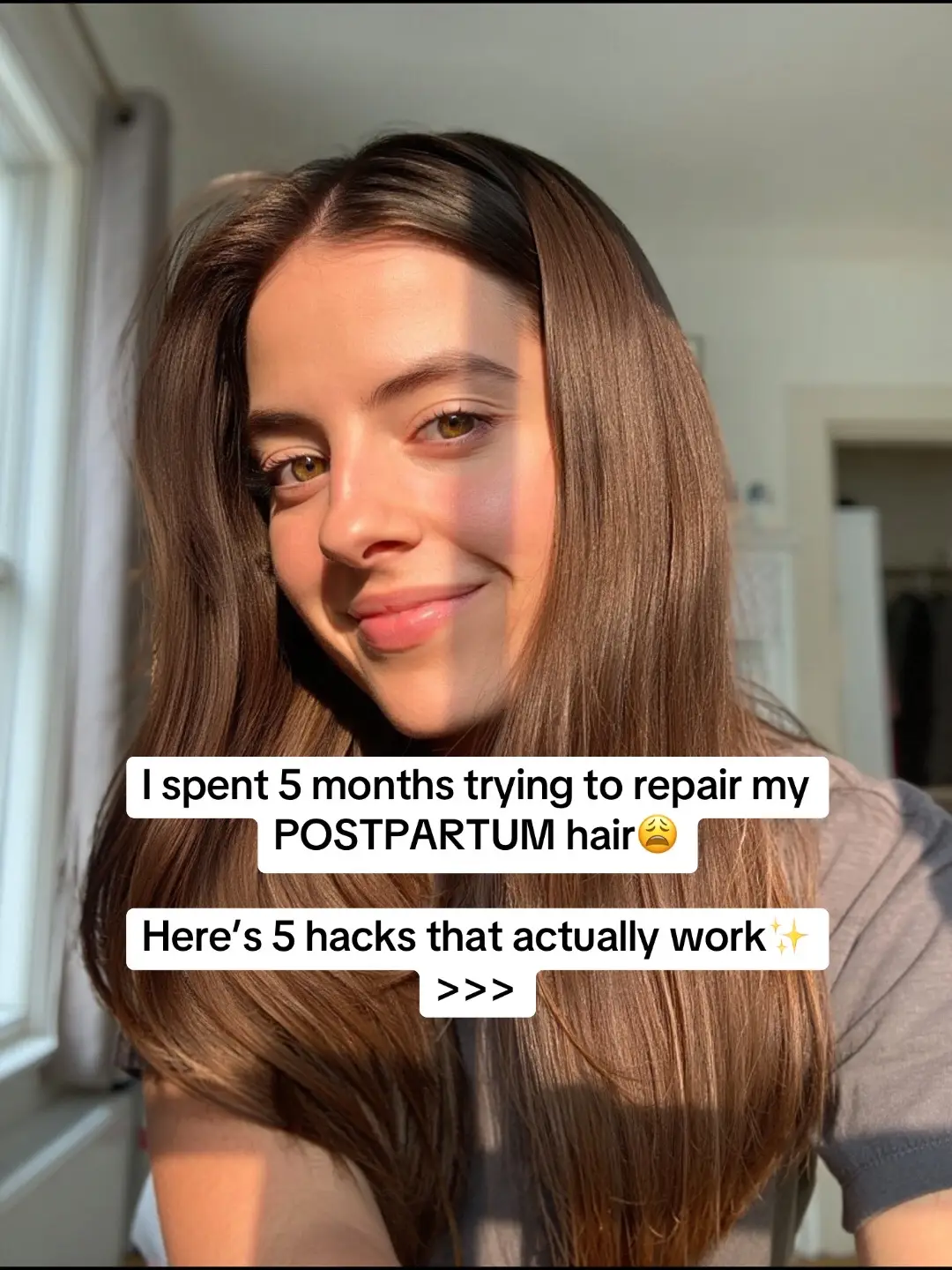 #postpartumhairloss #postpartumbody #newmomlife #postpartummom #fourthtrimester ID: 00351
