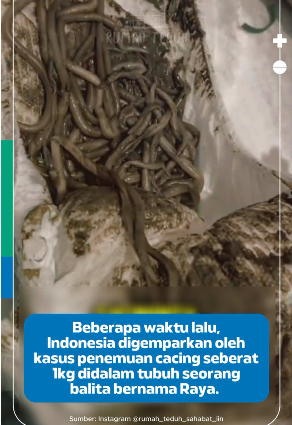 Kasus meninggalnya balita bernama Raya di Sukabumi beberapa waktu lalu menyita perhatian banyak orang. Raya ditemukan mengalami infeksi cacing gelang dalam jumlah banyak, ditambah dugaan TBC yang membuat kondisinya semakin berat. Peristiwa ini jadi pengingat buat kita semua bahwa anak-anak sangat rentan terhadap penyakit infeksi, apalagi bila asupan gizi kurang dan kebersihan lingkungan tidak terjaga. Cacingan bukan hal sepele jika tidak ditangani, bisa mengganggu tumbuh kembang anak hingga memperparah penyakit lain. #KlikDokter #JagaSehatmu #Cacingan