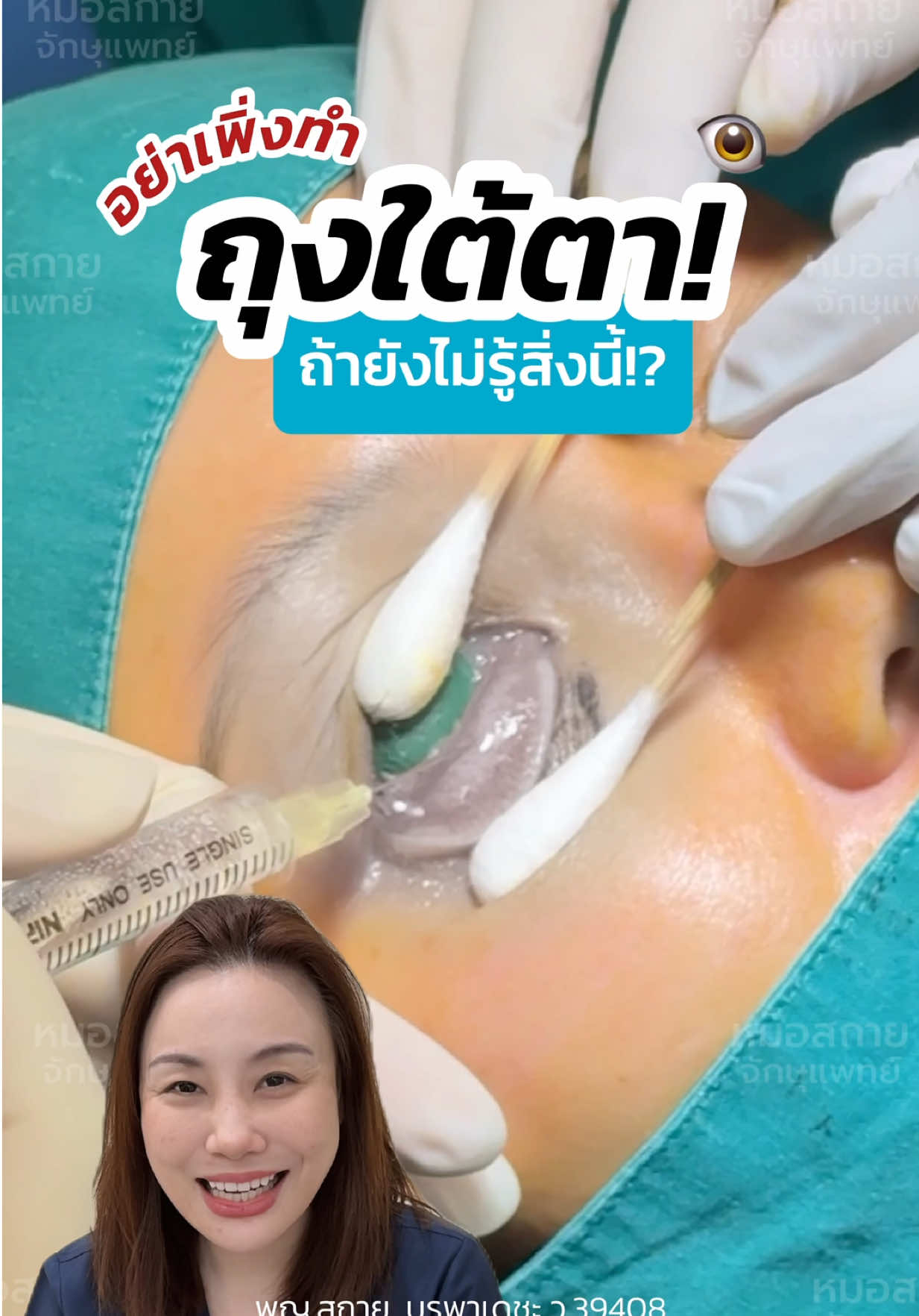 อย่าเพิ่งทำ #ถุงใต้ตา ถ้ายังไม่รู้สิ่งนี้⁉️ #หมอสกาย #ศัลยกรรมตา #skyclinic #จักษุแพทย์ 