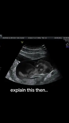I literally carried her for 9 months!! #babyween #ultrasound #pregnant #weenie #fyp 