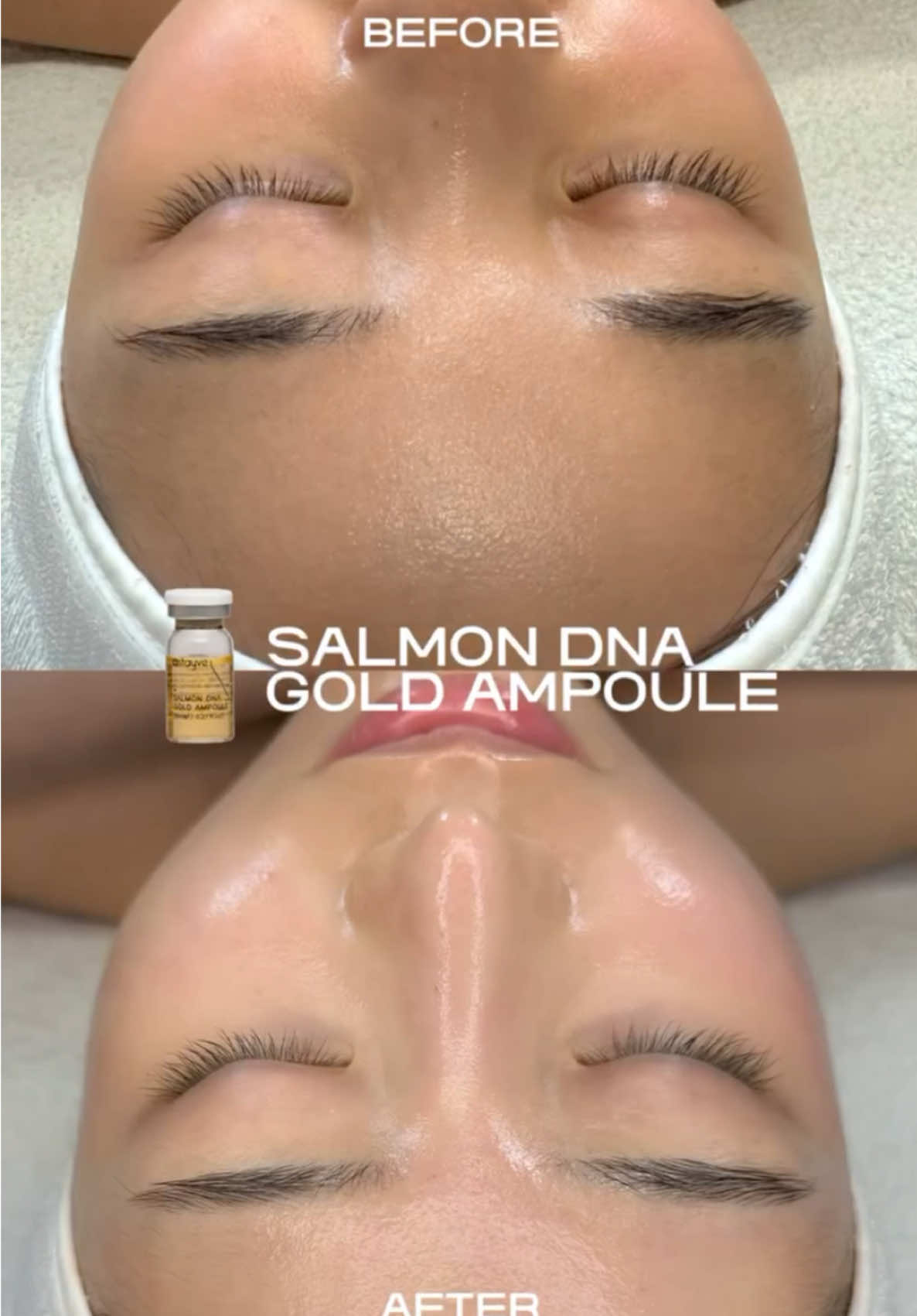 Salmon DNA just restocked - Limited quantity- Order Now at skinae.pk #salmondna #stayve #skinaepk #dermapen #antiaging 