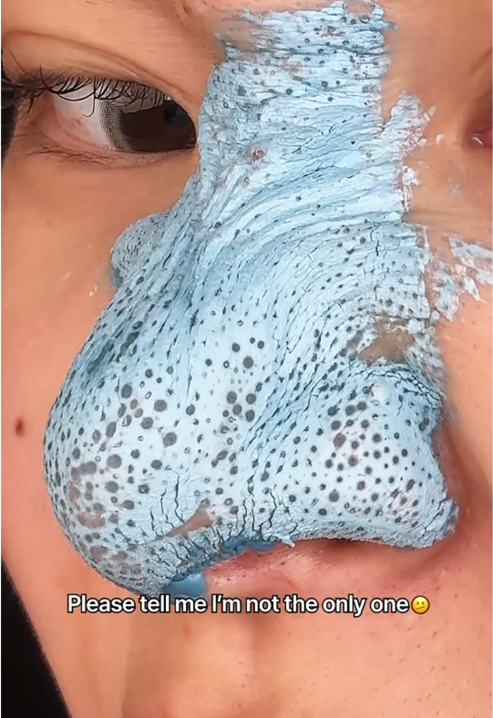 @medicube global pores looking clogged? this mask gets them right 💨 blackheads feel smoother, skin feels cleaner — and no tight, dry finish 💙🫧 #Medicube #beauty #skincare #tiktokmademebuyit #fyp 