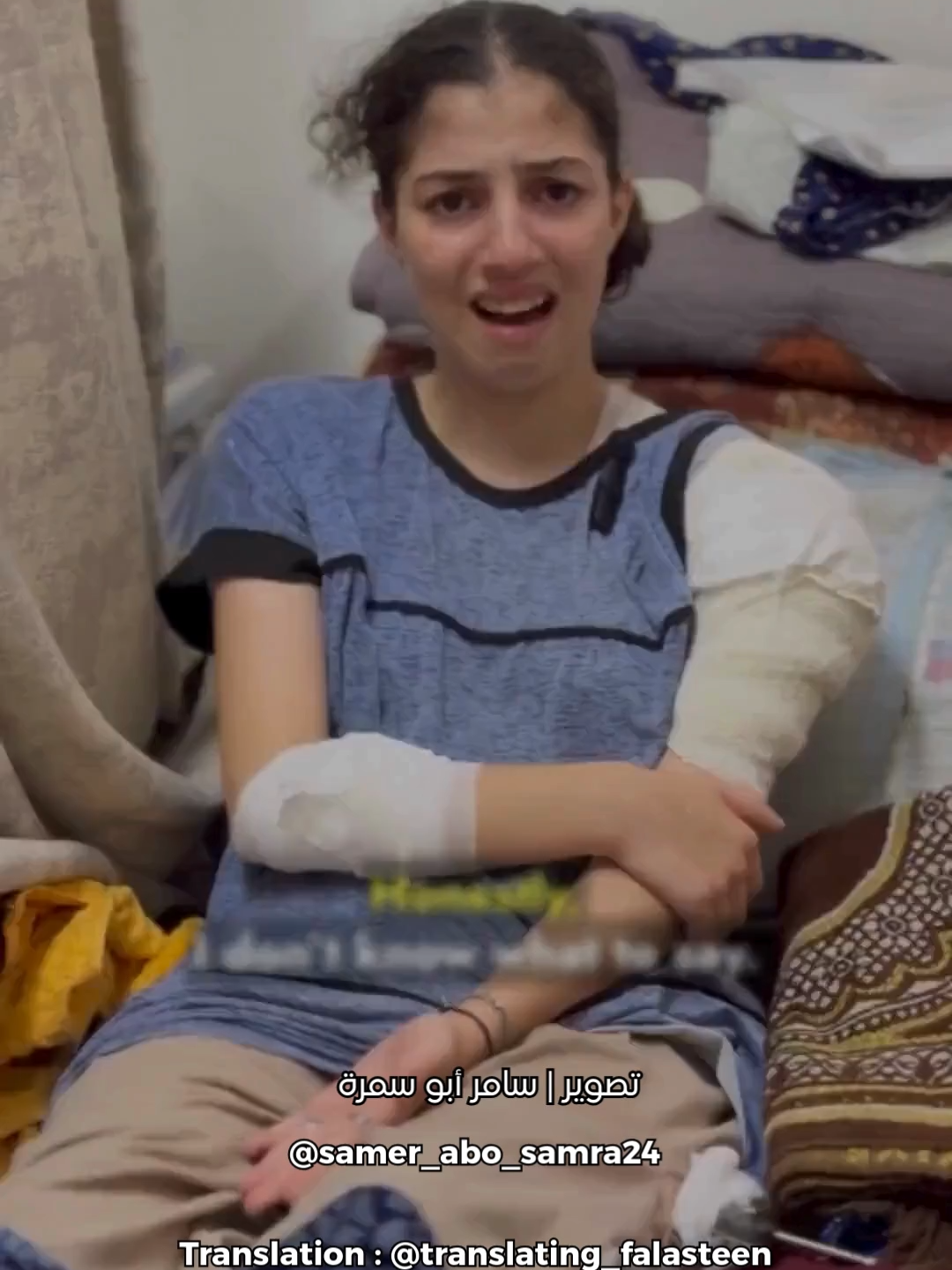 Alaa Mohiyi al-Din Muharram, 13, was severely injured by Israeli occupation bombing that struck near the tent where her family was sheltering. The blast shattered her shoulder, leaving her with no bone in the arm, and doctors warn she could lose it entirely without urgent surgery. Multiple reconstruction attempts have failed, leaving her arm open and infected, while her leg is pinned with metal plates that prevent her from walking. Alaa says she has been in the hospital for 67 days, surviving only on two Acamol pills, and endures dressing changes without anesthesia. Her referral papers are ready, but she is still waiting for a transfer abroad to save her arm and regain her mobility. To contact the family: 00972592852792. علاء محيي الدين محرم، 13 عاماً، أُصيبت بجروح خطيرة جراء قصف الاحتلال الإسرائيلي بالقرب من الخيمة التي كانت عائلتها تحتمي بها. الانفجار حطم كتفها بالكامل، تاركاً ذراعها بلا عظم تقريباً، ويحذر الأطباء من أنها قد تفقده نهائياً إذا لم تُجرَ لها عملية عاجلة. محاولات الترميم فشلت، وذراعها ما زالت مفتوحة ومصابة بالتهاب، بينما ساقها مثبتة بشرائح معدنية تمنعها من المشي. تقول علاء إنها في المستشفى منذ 67 يوماً لا تتلقى سوى حبتين من عقار الأكامول، وتتحمل تغيير الضماد من دون تخدير. أوراق تحويلها جاهزة لكنها ما زالت تنتظر الإجلاء الطبي للعلاج بالخارج لإنقاذ ذراعها واستعادة قدرتها على الحركة. للتواصل مع العائلة: 00972592852792. Source: @samer_abo_samra24  Translation: @translating_falasteen