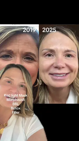 #greenscreen Yesterday I turned 54 and my skin has never looked better. Tomorrow at 1:30 pm I will be live with @DrMelaniePetro and she will answer questions and discuss procedures. In my Linktree you can find her website and a code that offers a discount on all of the products I use including the sunscreen, redlight therapy mask, sunblock and of course drops of Jupiter. #beauty #agingbackwards #skincare #women  