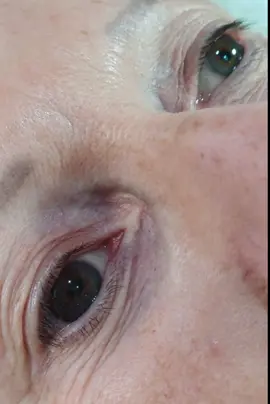 #CapCut #eyes #GlowUp #eyelashes