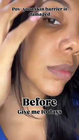 Haru Haru Sunstick – This sunscreen stick is so easy to apply, perfect for reapplying during the day without messing up your makeup. It feels lightweight, non-greasy, and leaves the skin protected with a natural finish. #haruharutoner #haruharuwonder #glazingmilk @haruharu wonder @YesStyleInfluencers @YesStyle  💧 Haru Haru Barrier Essence – A soothing and hydrating essence that helps strengthen the skin barrier. It absorbs quickly, calms irritation, and leaves the skin plump and refreshed. You can find both products on yesstyle.com, and don’t forget to use my discount code leidyMR21 for extra savings! 