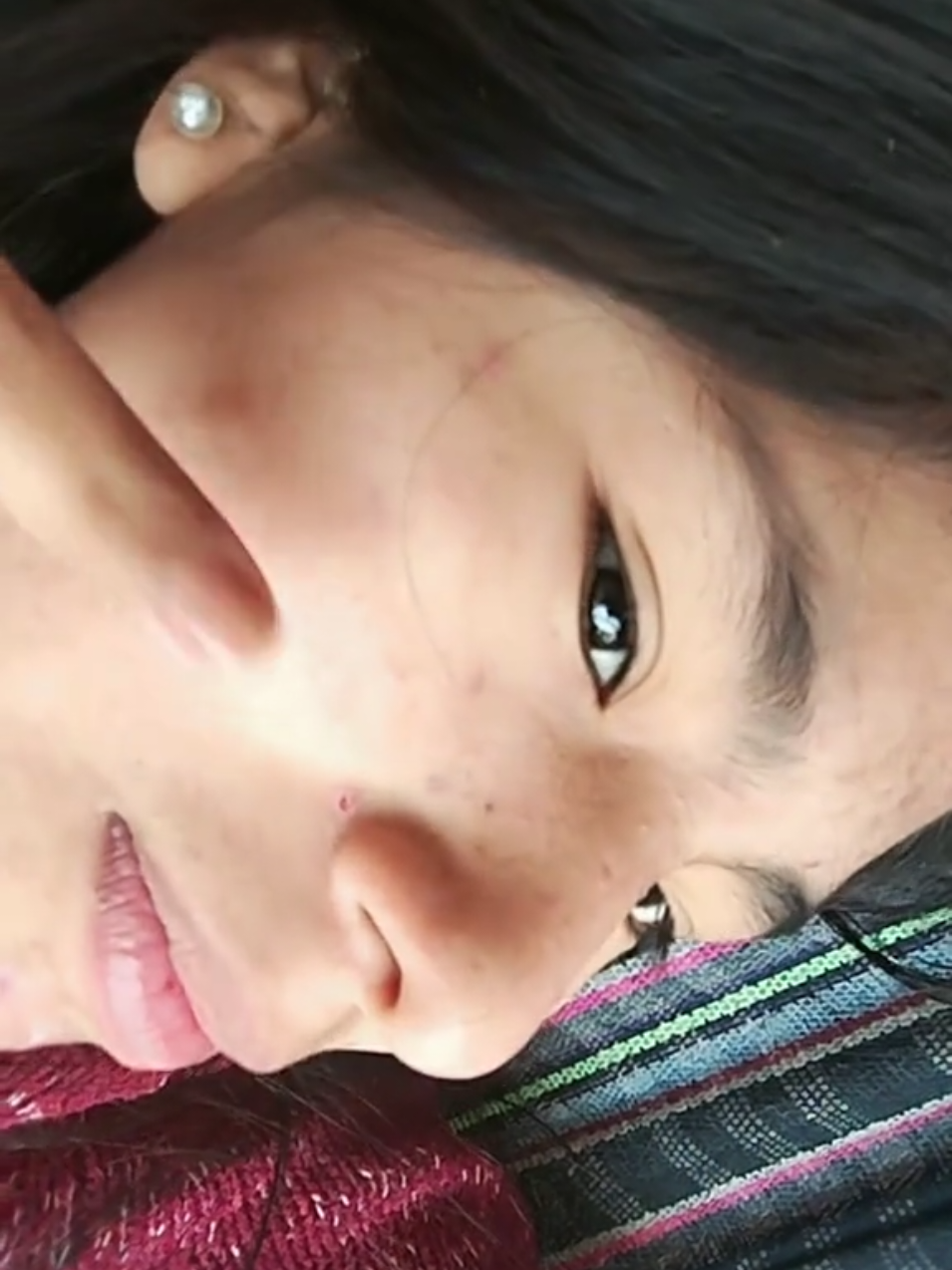 😆 algo que me recomiende algo🤦 alguna recomendación #paratiiiiiiiiiiiiiiiiiiiiiiiiiiiiiii #acne #ayuda 