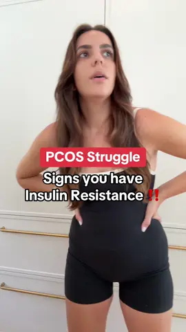 PCOS & insulin resistance can look different for everyone! Symptoms like swollen feet, frequenting the bathroom, always craving sugar, and drinking tons of water are all signs that you may be struggling with insulin resistance. #pcos #pcosweightloss #pcosawareness #pcoslife #pcosproblems 